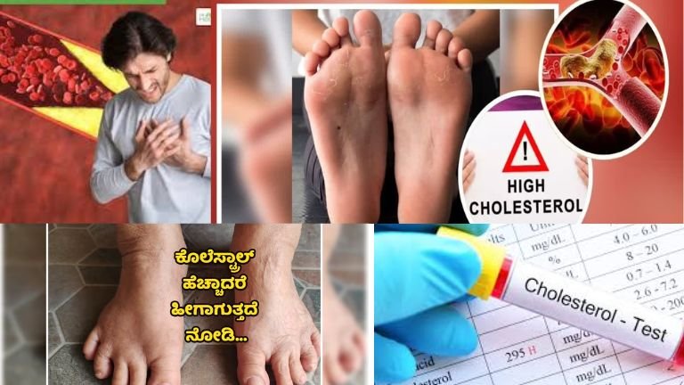 High Cholesterol ಲಕ್ಷಣಗಳು